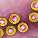 Image of Cold sore virus 'treats skin cancer'